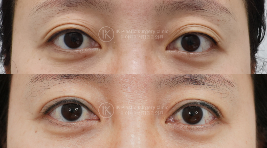 3d7fe9728fb1b.jpg