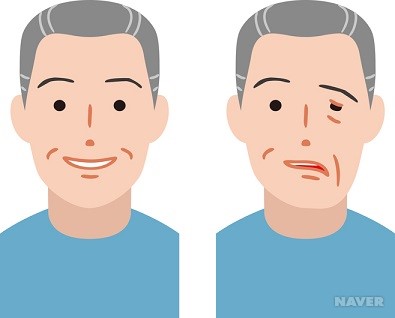 얼굴이 이상해요. 어떻게 하죠?