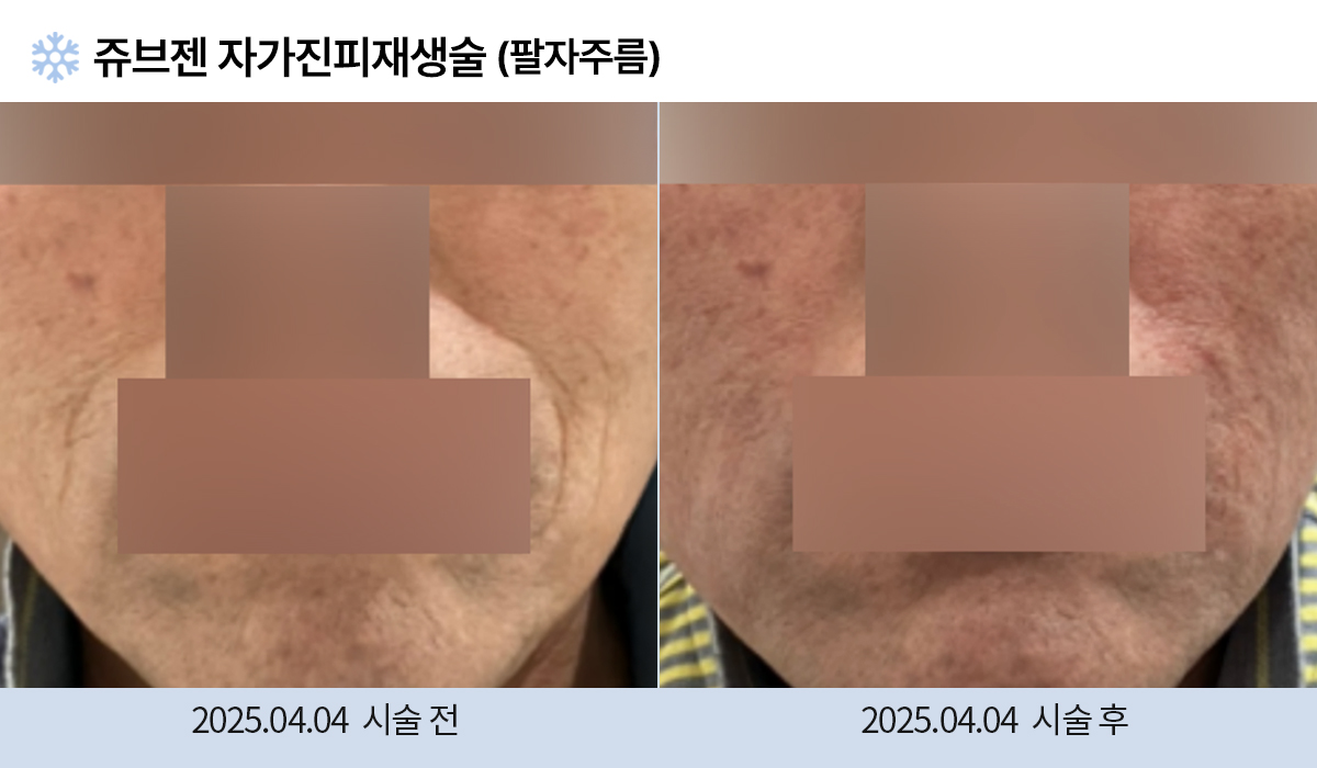 주름완화 이미지