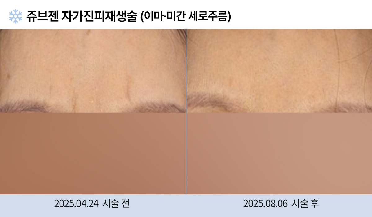 주름완화 이미지