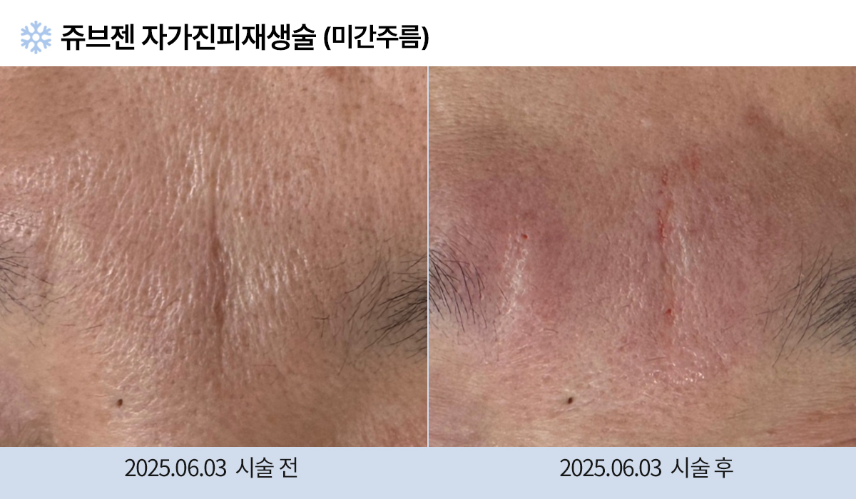 주름완화 이미지