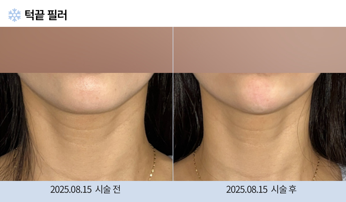 주름완화 이미지