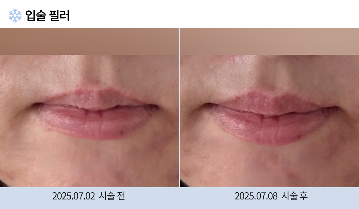 주름완화 이미지