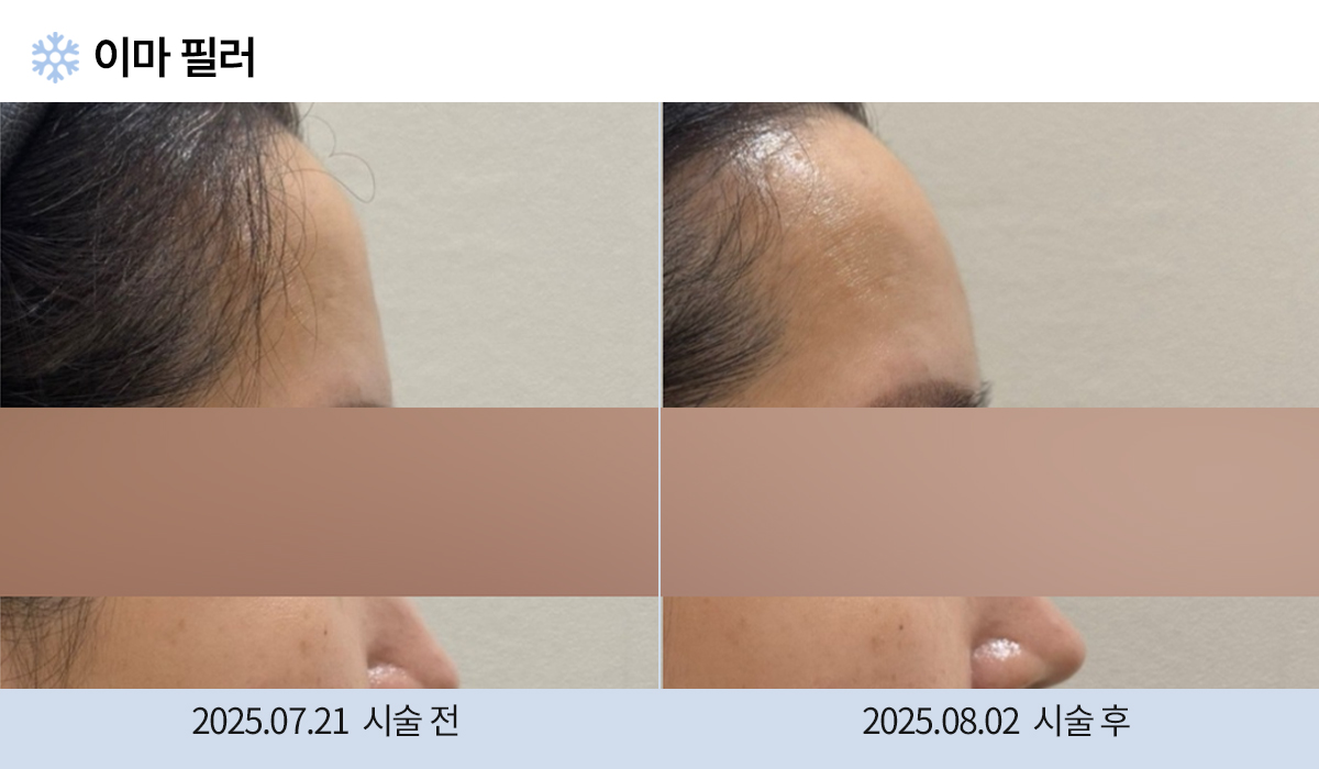 주름완화 이미지