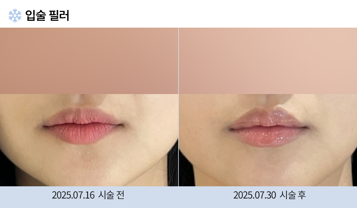 주름완화 이미지