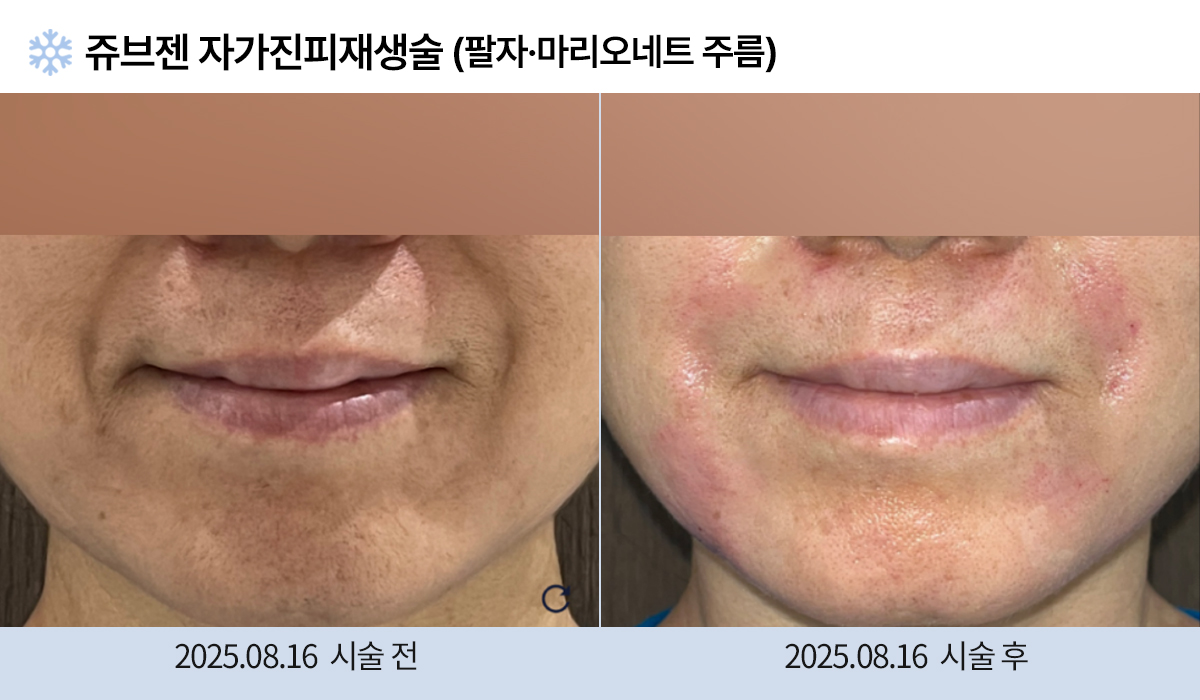 주름완화 이미지