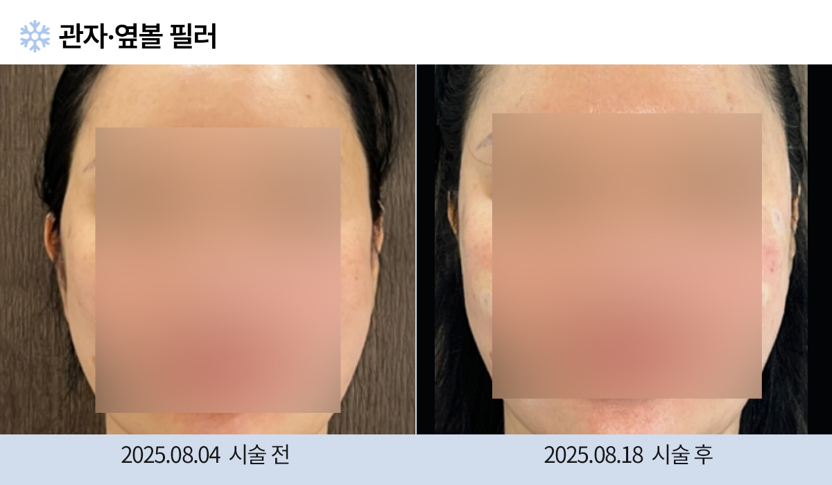 주름완화 이미지