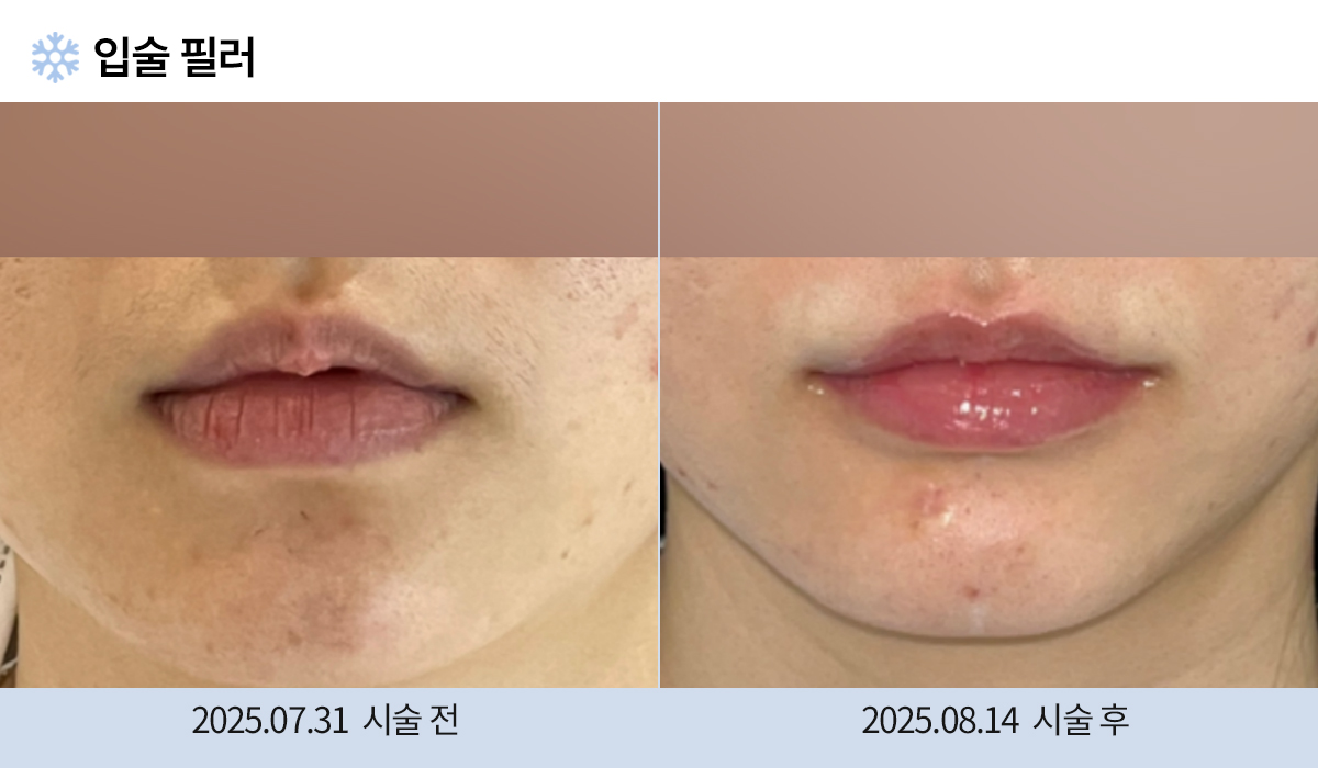 주름완화 이미지