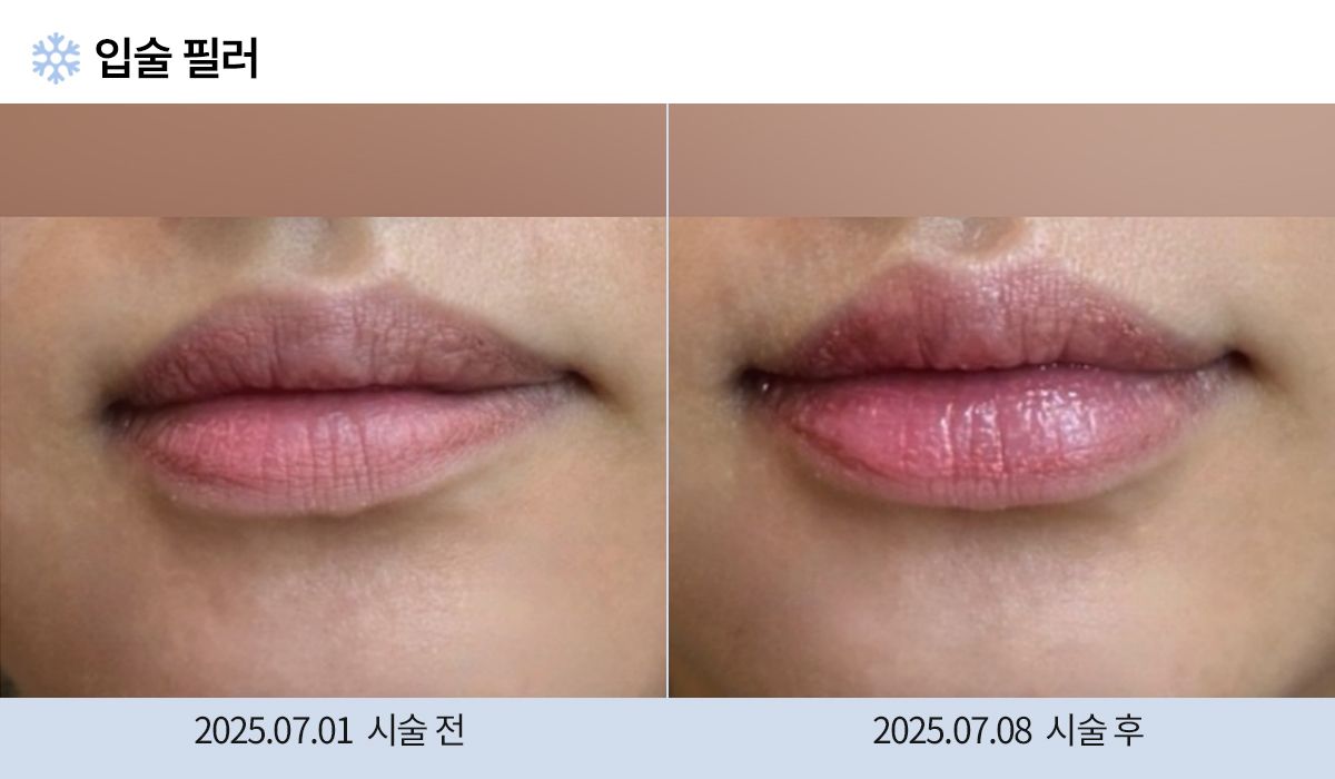 주름완화 이미지