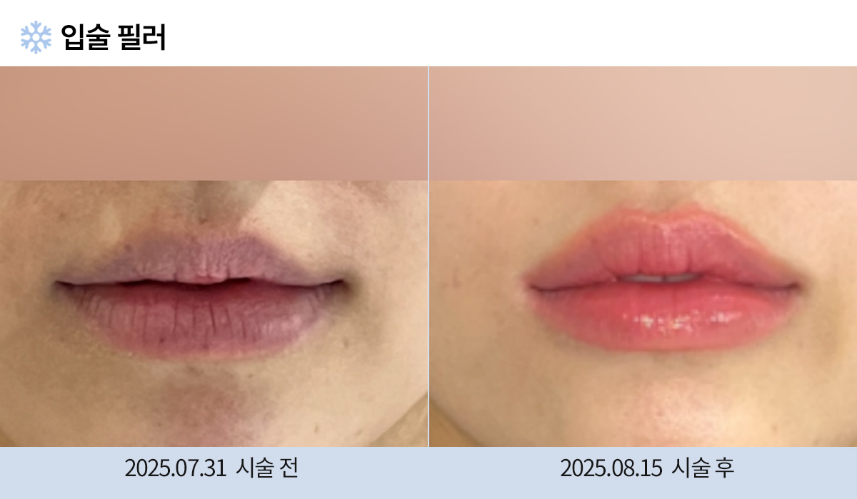 주름완화 이미지