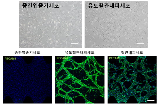 중간엽줄기세포와 연구팀이 개발한 혈관내피세포. /사진=한국보건산업진흥원 제공