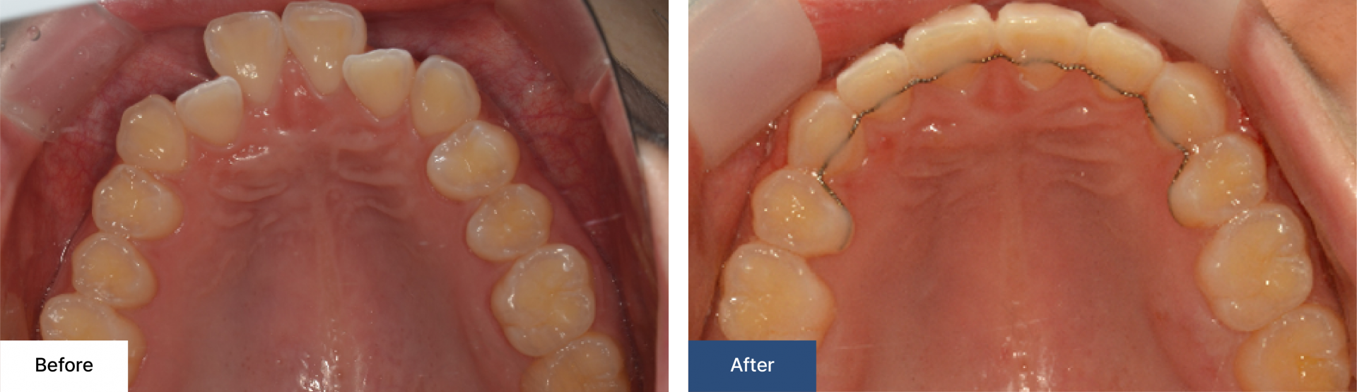 Orthodontics 3