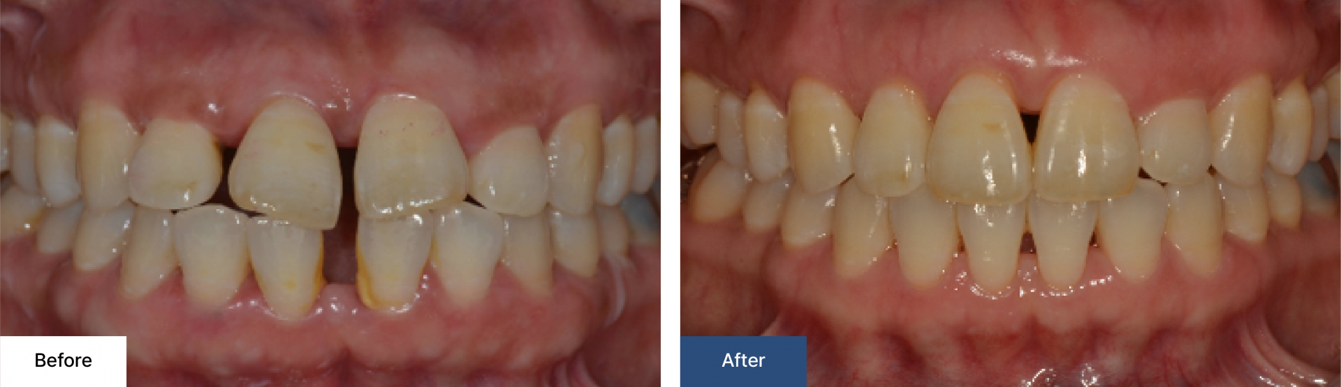Orthodontics 2