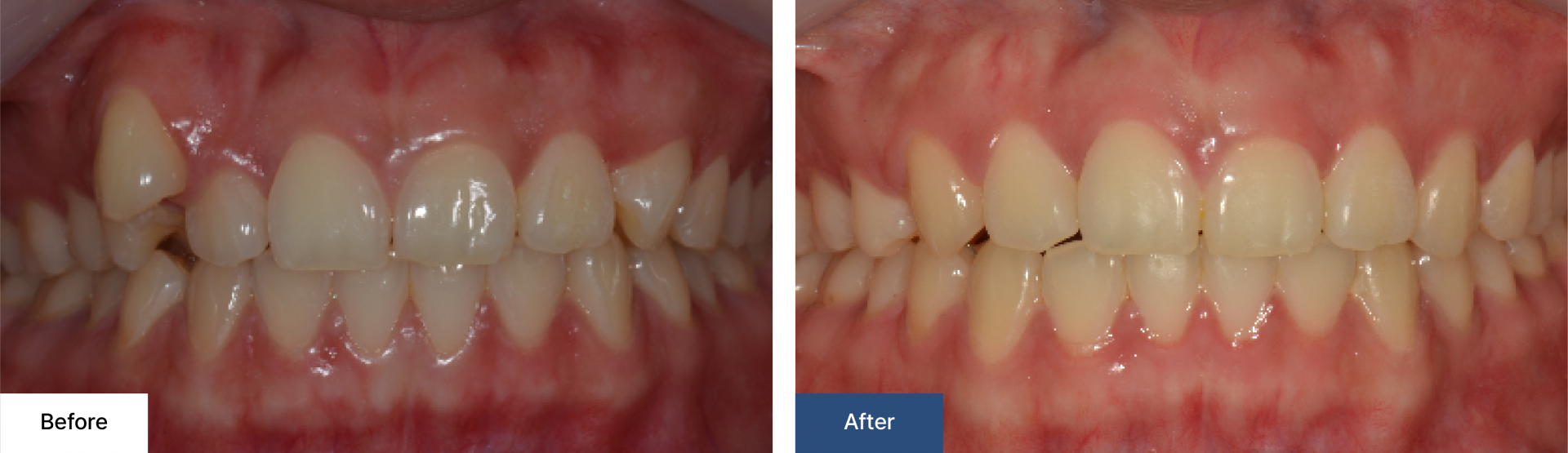 Orthodontics 1