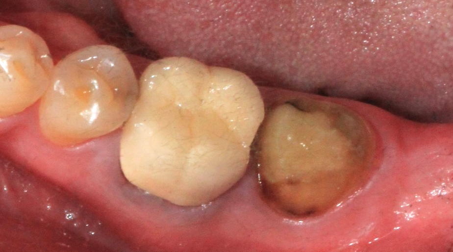 Case 2