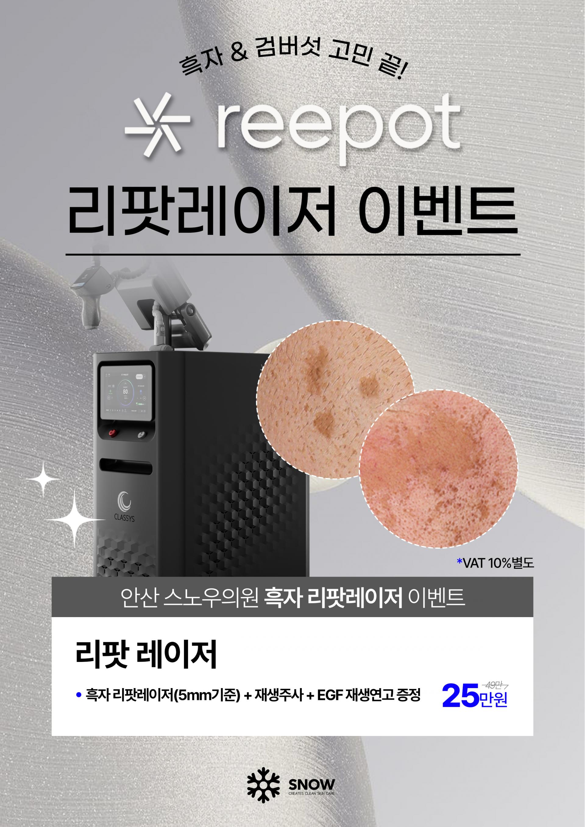 리팟레이저 EVENT