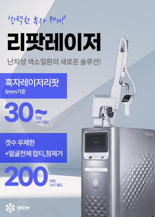 리팟레이저 EVENT