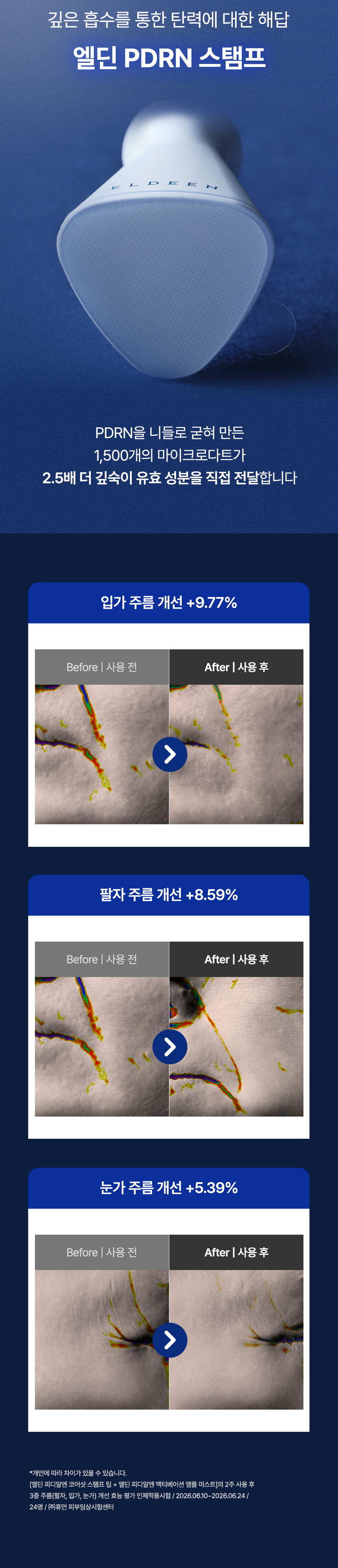 코어샷 스탬프 프로그램 10회분 PDRN 마이크로 코어샷 피부 홈케어