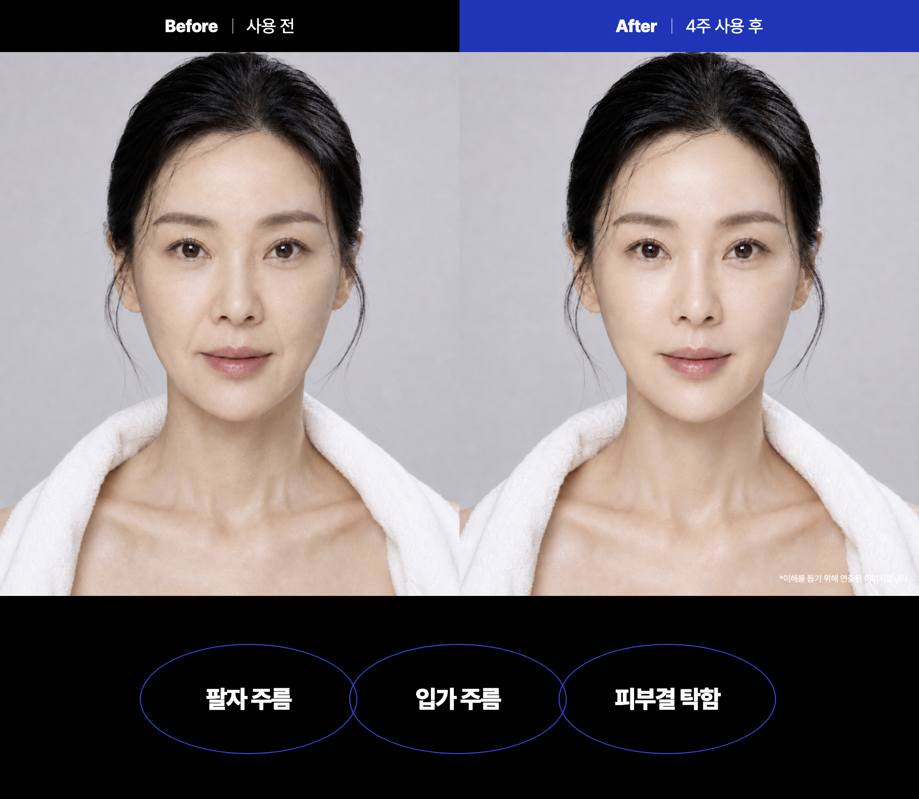 코어샷 스탬프 프로그램 10회분 PDRN 마이크로 코어샷 피부 홈케어