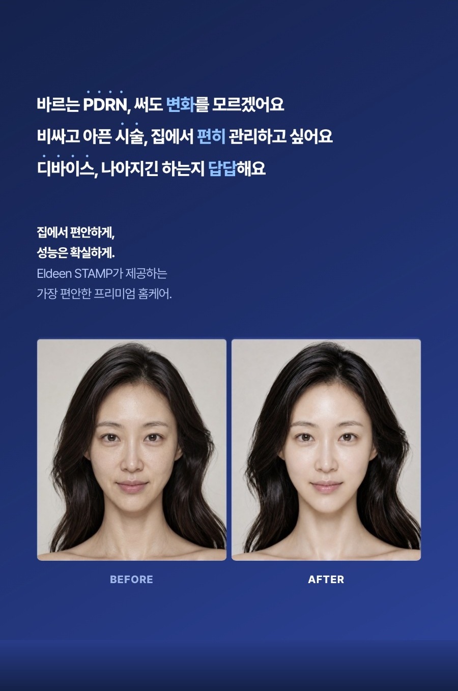 [🤫비밀링크] 엘딘 PDRN 코어샷 스탬프 프로그램 10회분