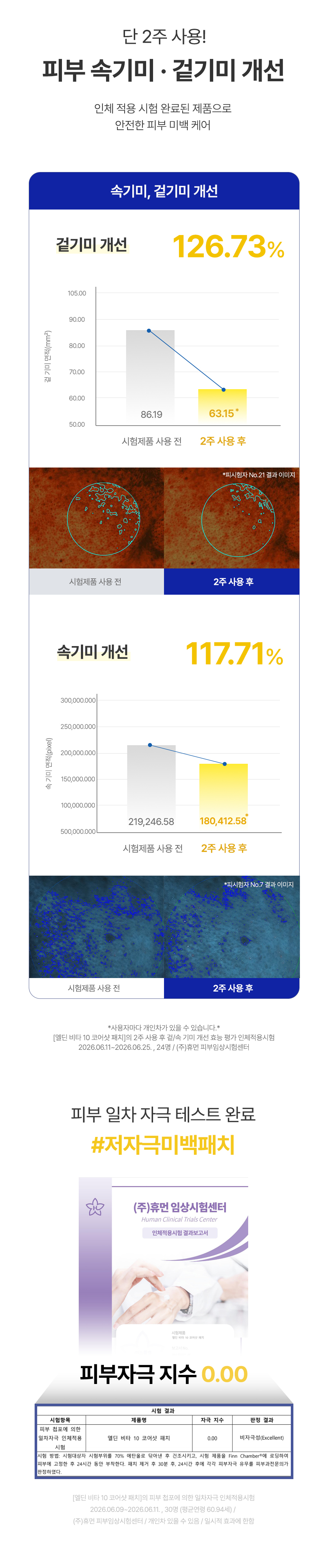 비타 10 코어샷 패치 비타민10% 미백기능성 패치 기미/잡티 고민 해결
