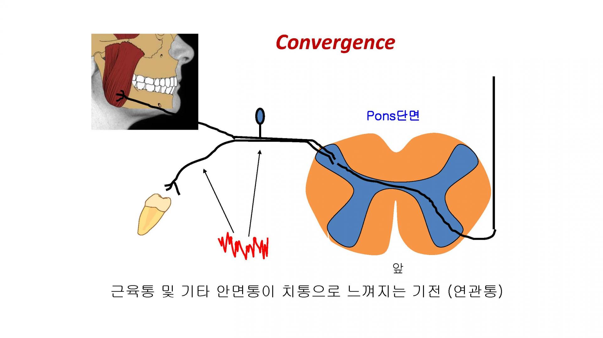비치성 통증-근관치료 (수정본KST)_페이지_39.jpg
