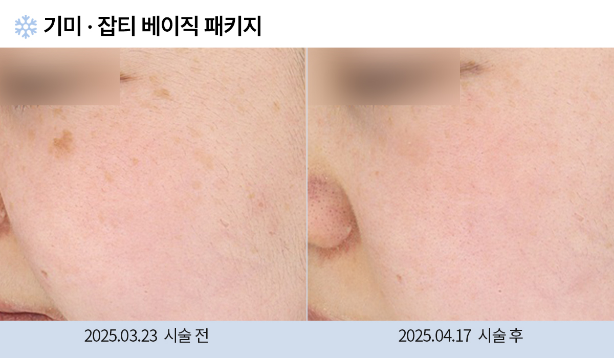 노원피부과진료 | 스노우의원 노원점, 노원보톡스, 노원여드름
