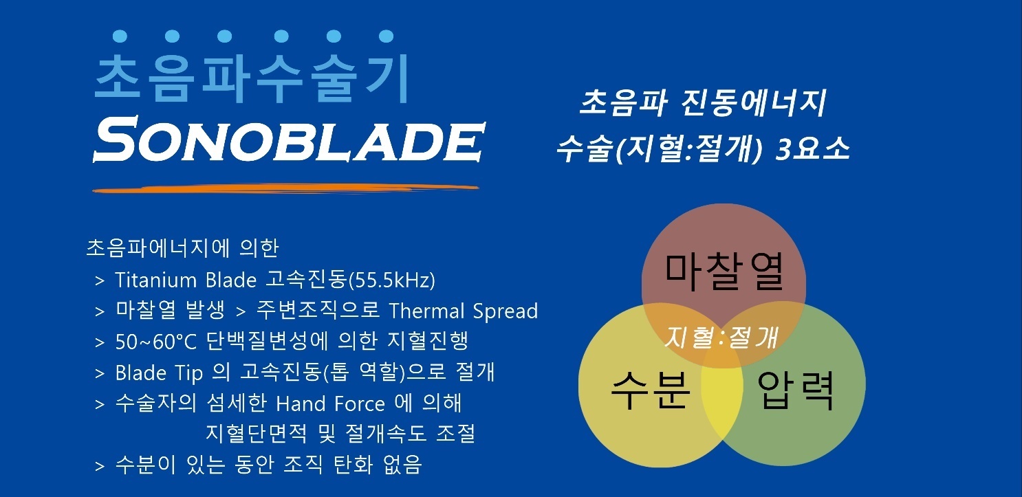 소노블레이드 시저