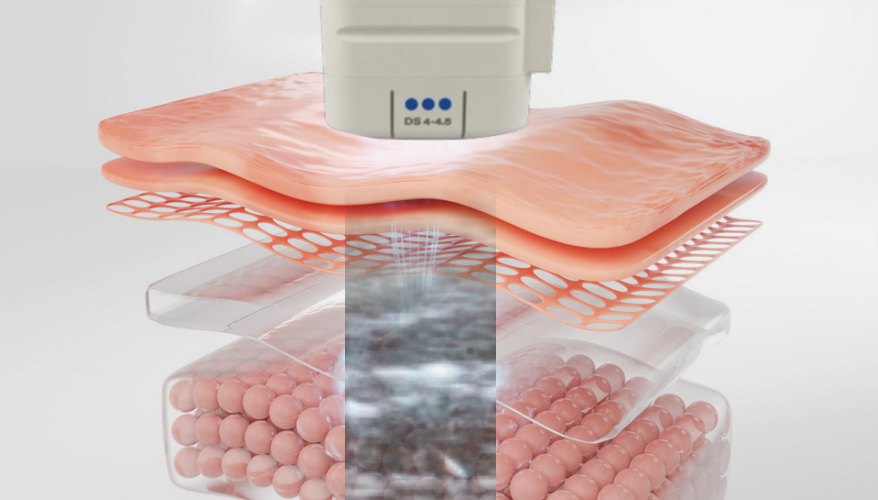 깊은 층 집중 리프팅