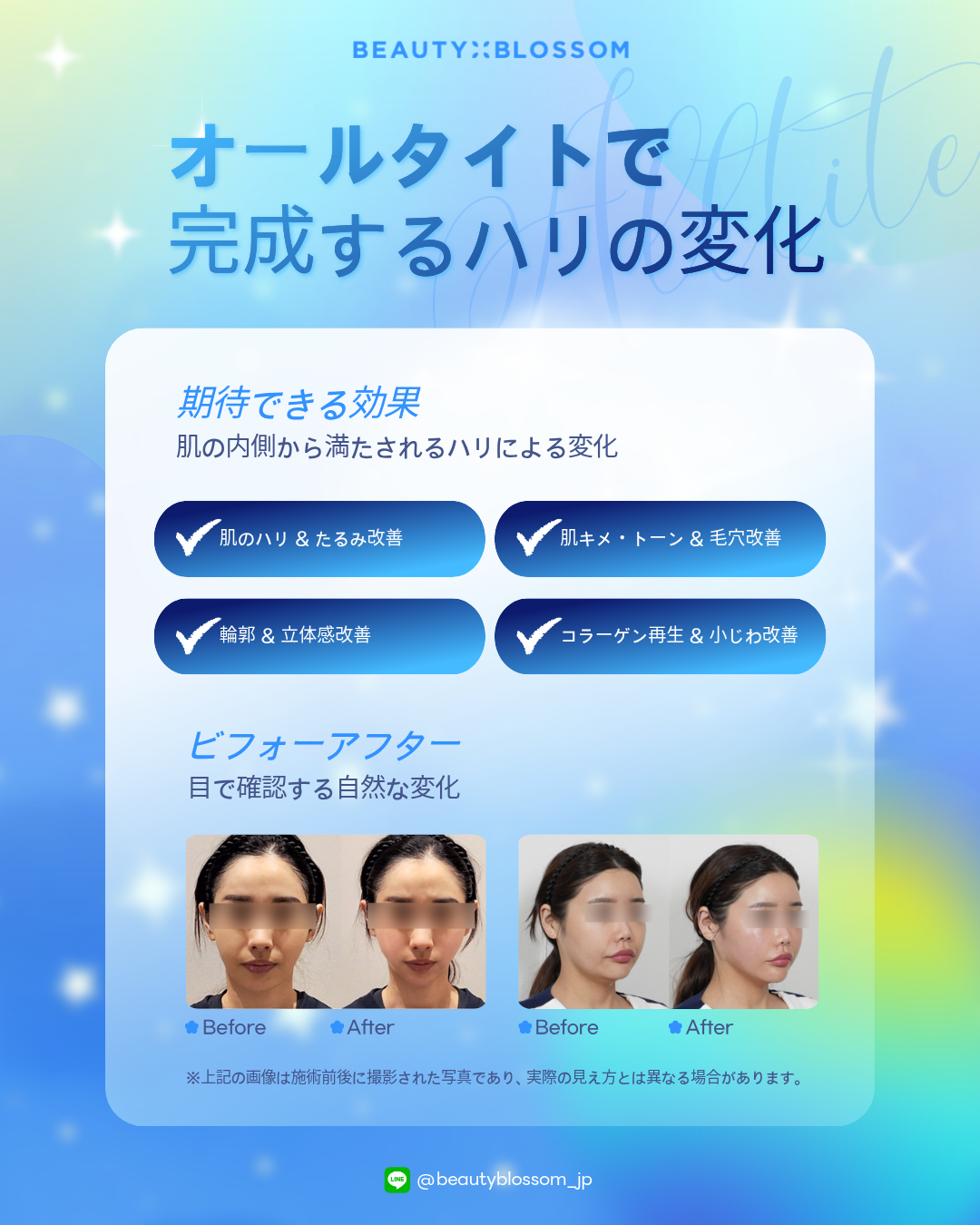 3bd44225d2ae7.png