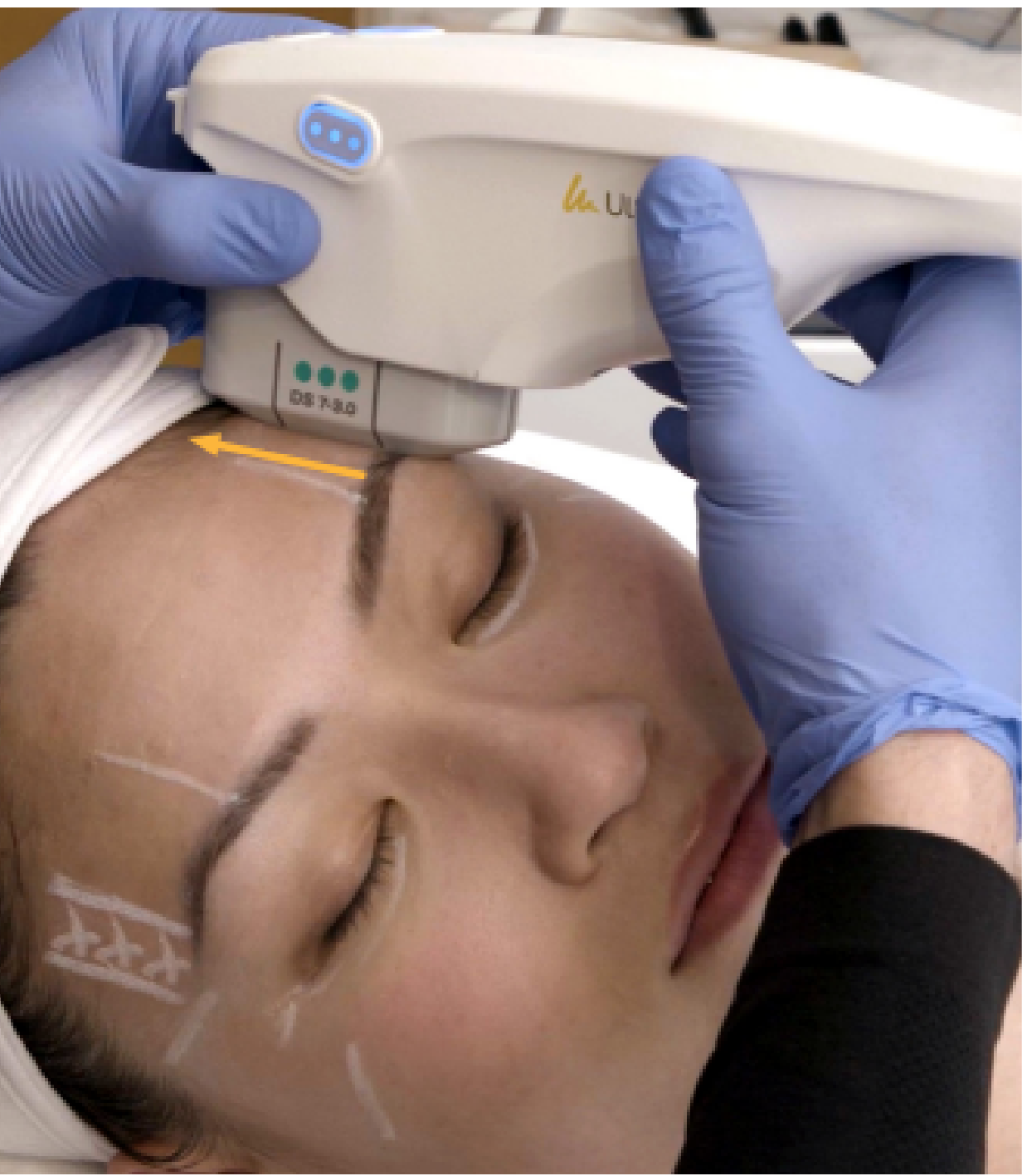 20% 빨라진 시술 속도