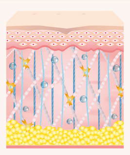 성숙 및 리모델링