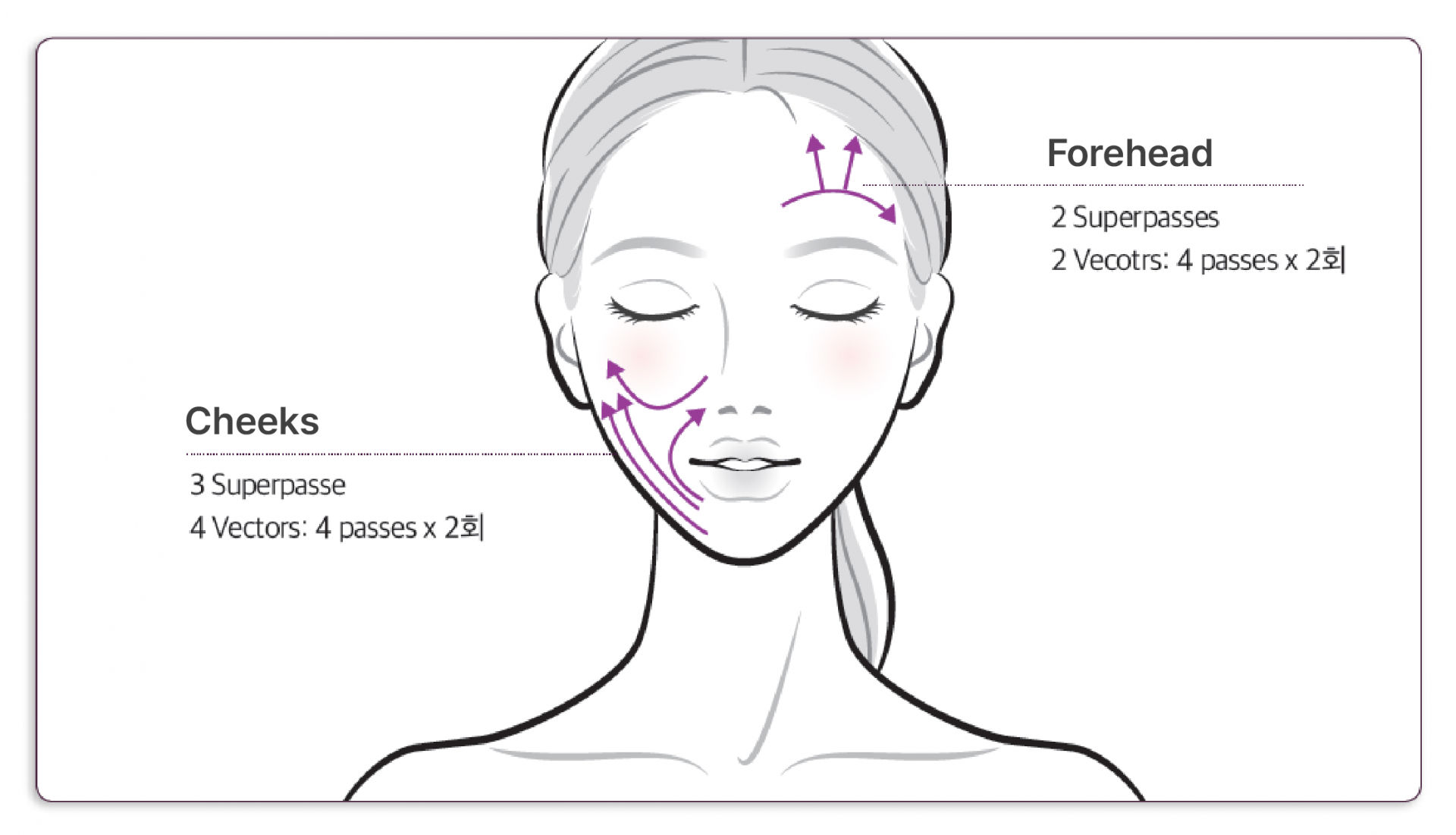 Thermage FLX Treatment Area Illustration