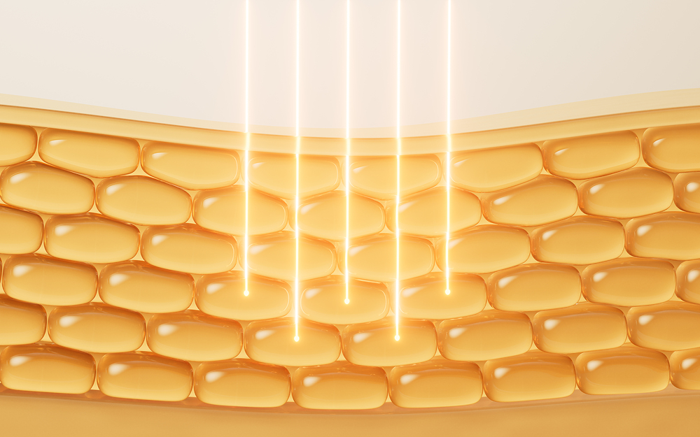 지속적 탄력 개선