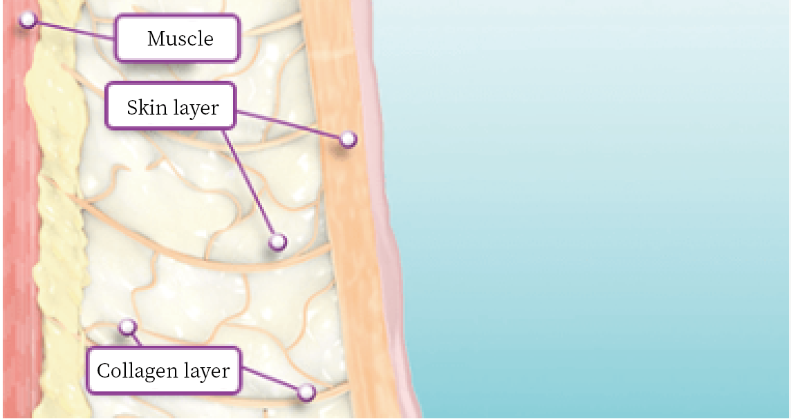 Initial Warming Phase