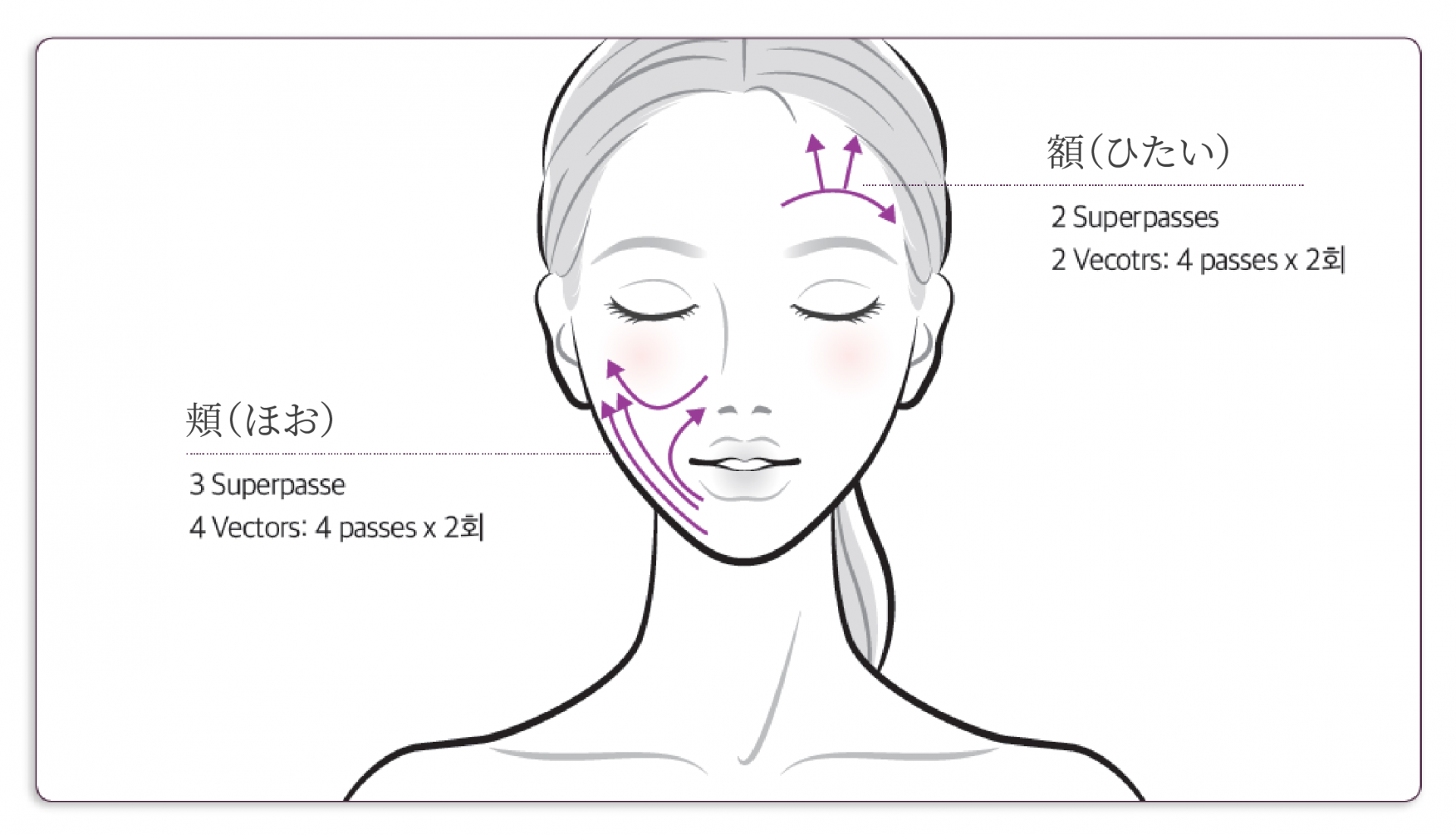サーマジFLX施術部位イラスト
