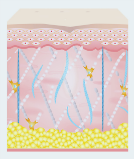 일시적 염증 반응