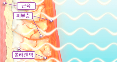 고주파 에너지 전달 단계