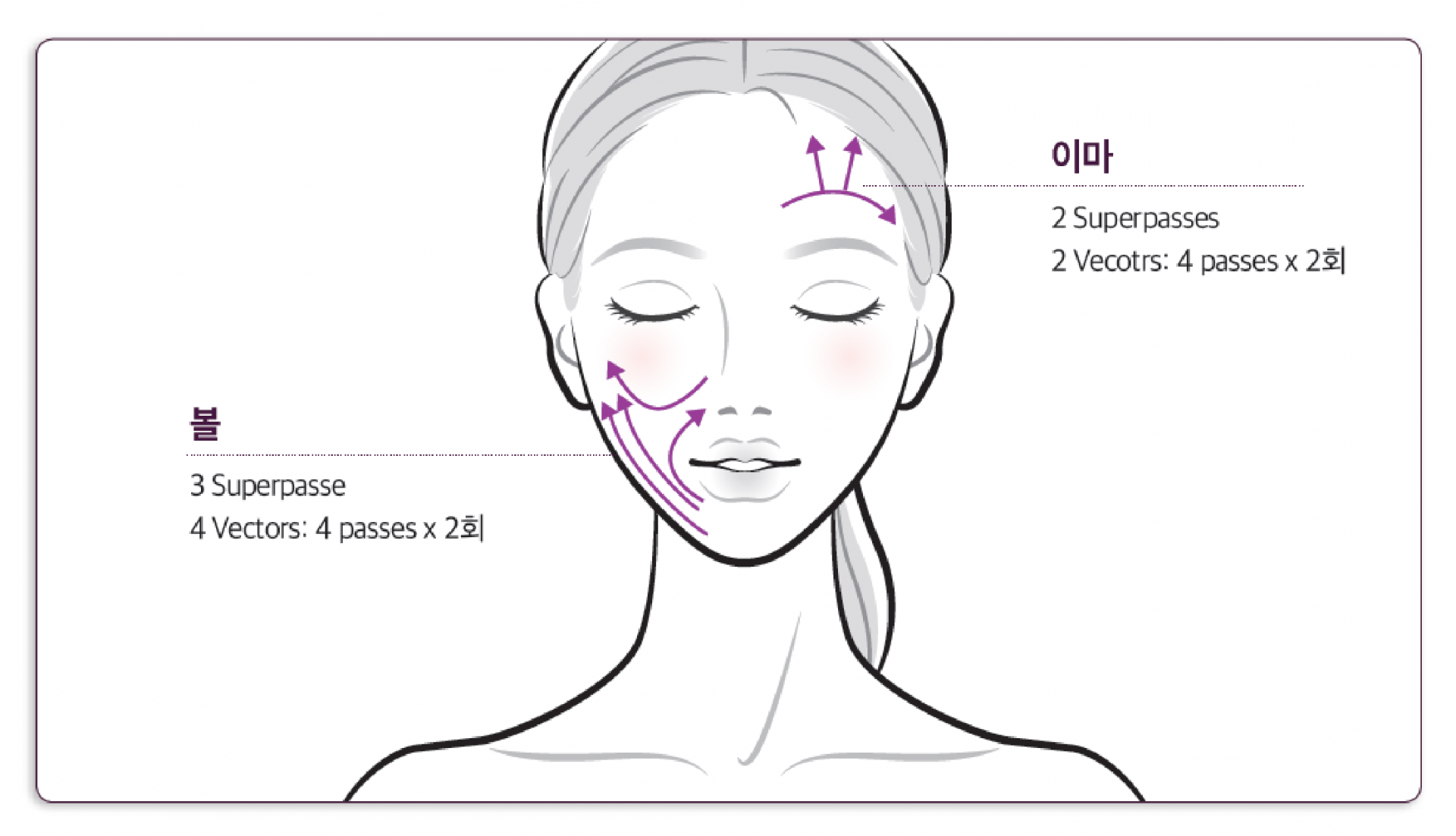 써마지 FLX 시술 부위 안내 일러스트