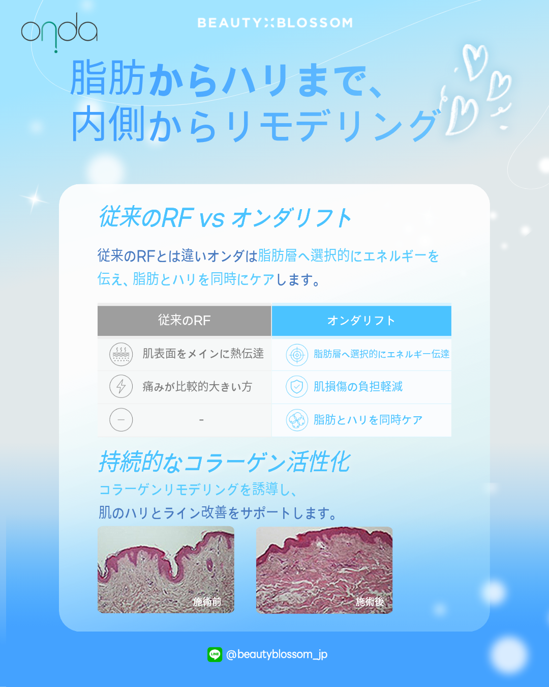 e4c1a629414ac.png