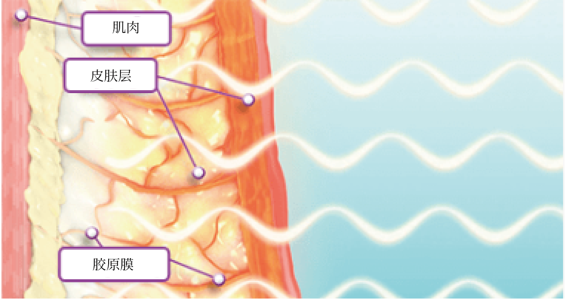 射频能量传导阶段