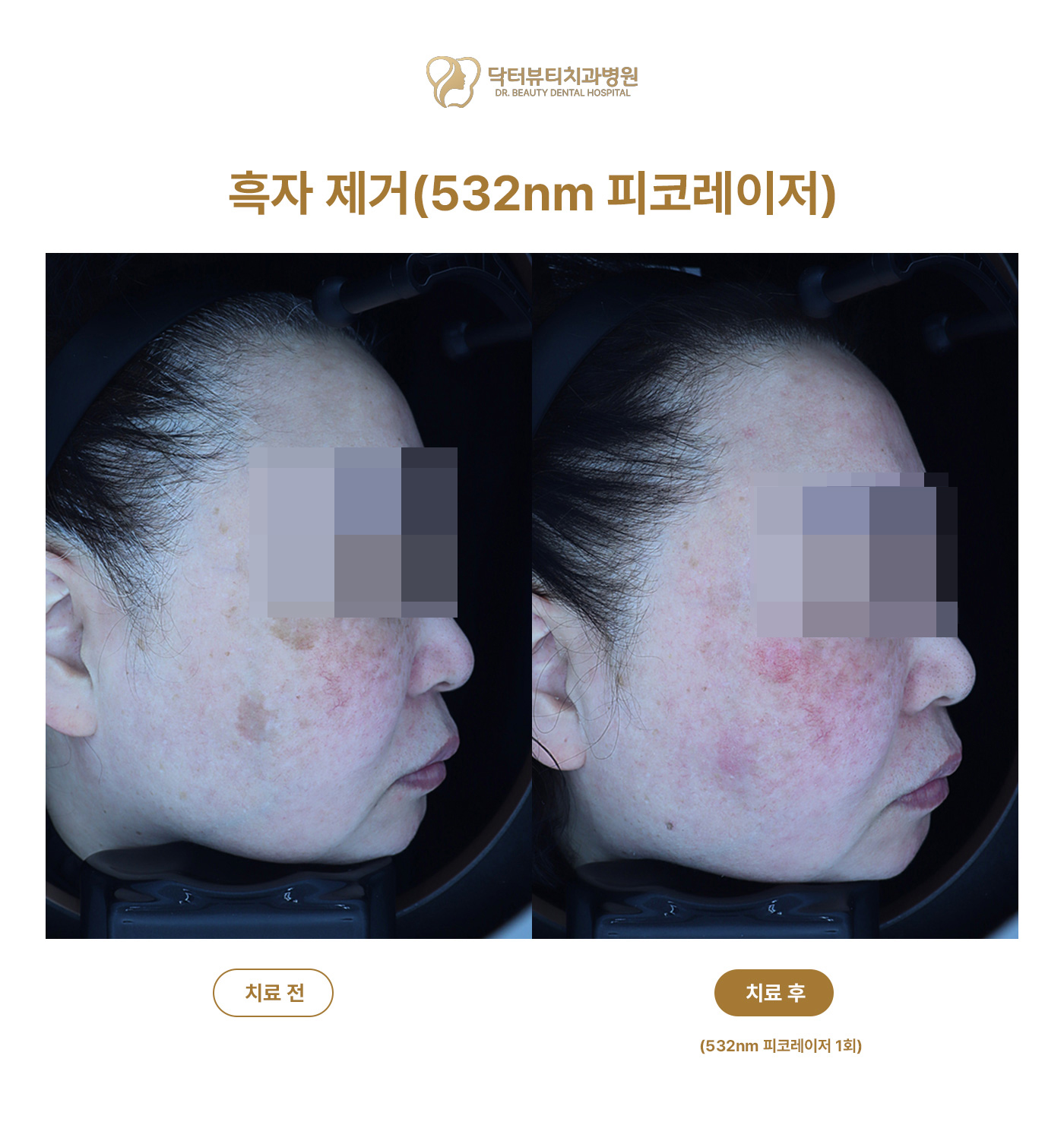 359a62b7afeb1.jpg