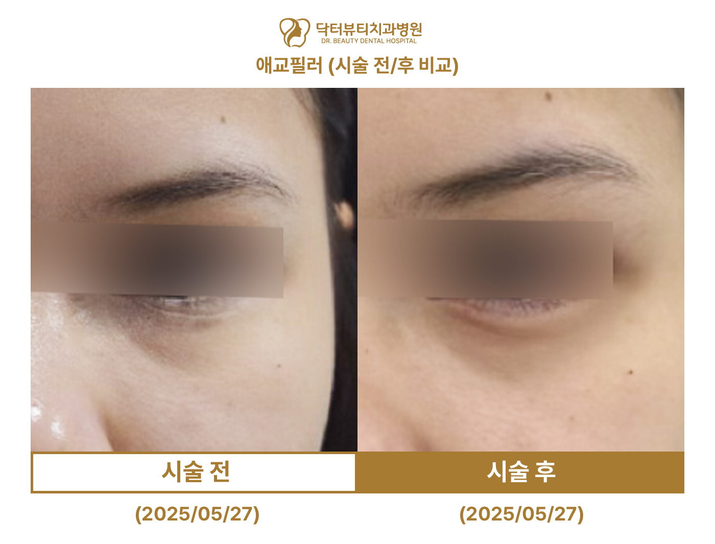 e1b37cd0878a9.jpg