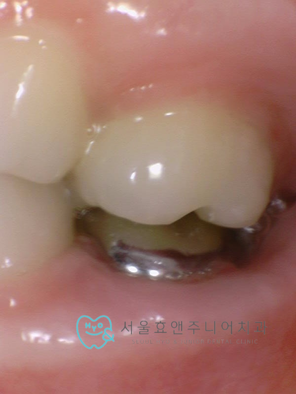 1fd06731be988.jpg