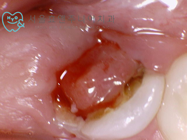8b190ca2460ec.jpg