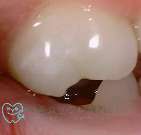 955d6abbca335.jpg