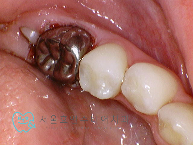b43de1c4e1db4.jpg