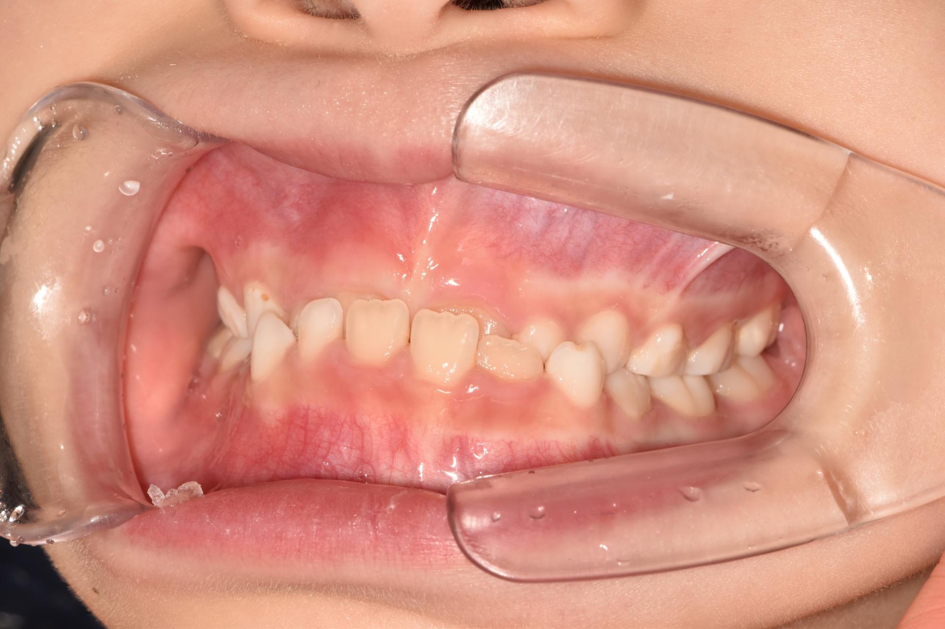 b88bd3702e1fb.jpg