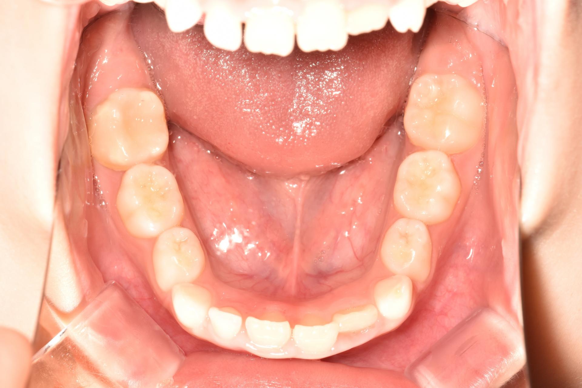 bdc6be5277069.jpg