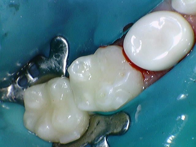 beacb13403256.jpg